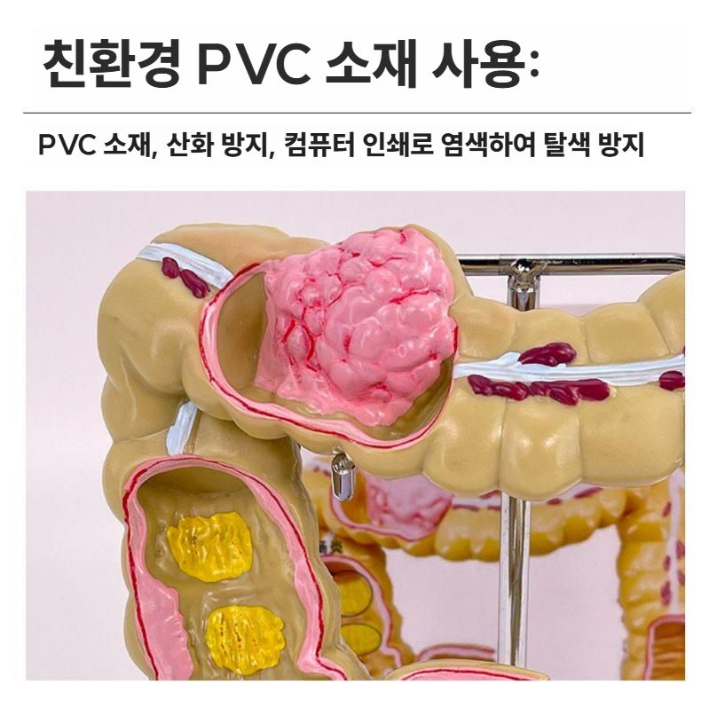 대장 해부학 모형 직장 위장 교구 병원 설명용 샘플 직장 모형 - 상세 이미지 5
