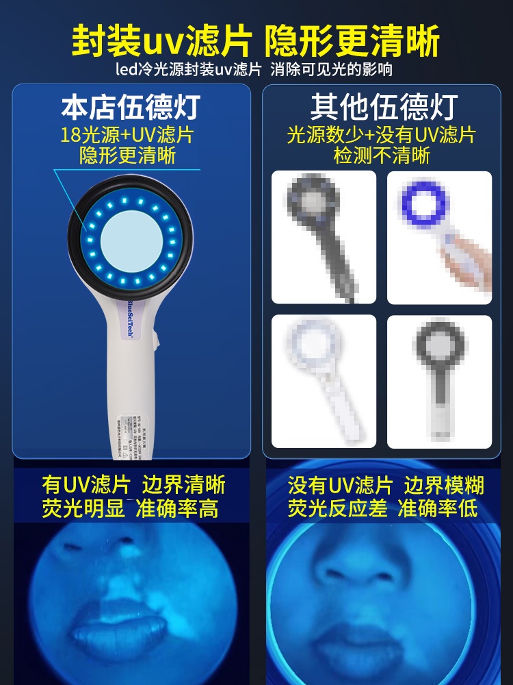 피부감지기 진단기 확대경 피부 UV 분석기 검사기 우드램프 정밀 - 상세 이미지 3