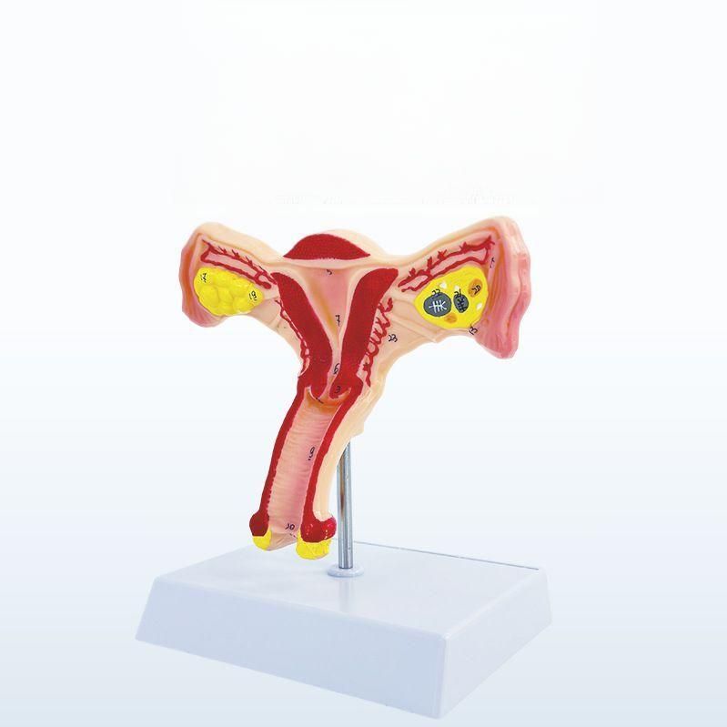 산부인과 자궁모형 난소 여성 생식기 구조 교구 해부도 양측 난소 자궁 - 메인 이미지