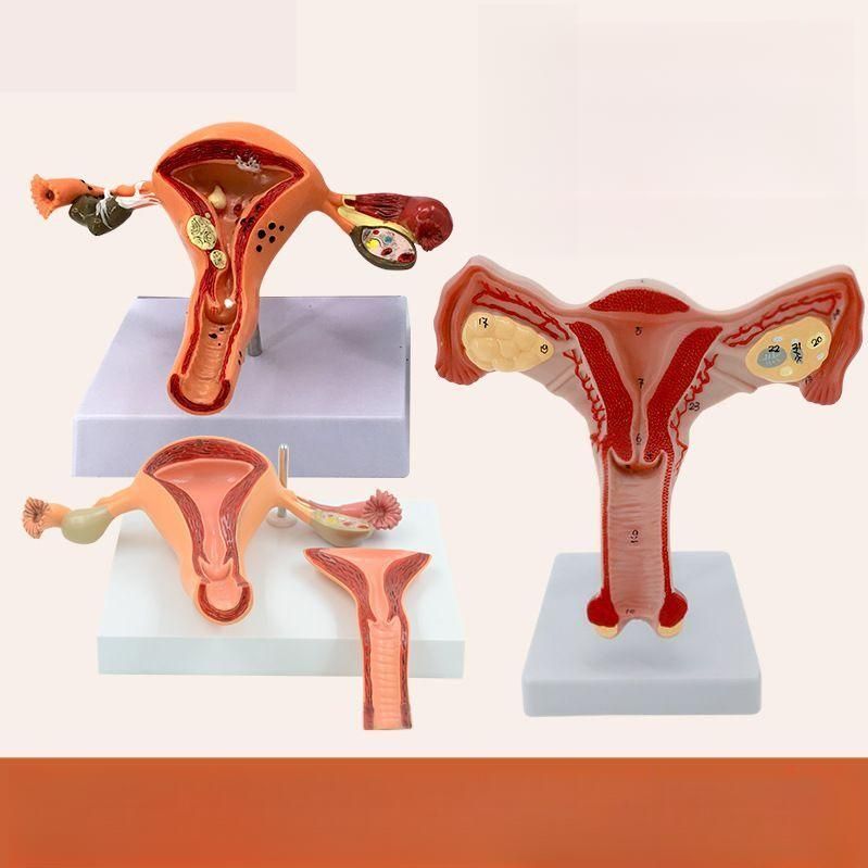 산부인과 자궁모형 난소 여성 생식기 구조 교구 해부도 양측 난소 자궁 - 상세 이미지 4