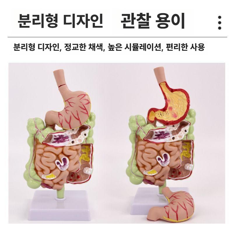대장 해부학 모형 직장 위장 교구 병원 설명용 샘플 직장 모형 - 상세 이미지 4