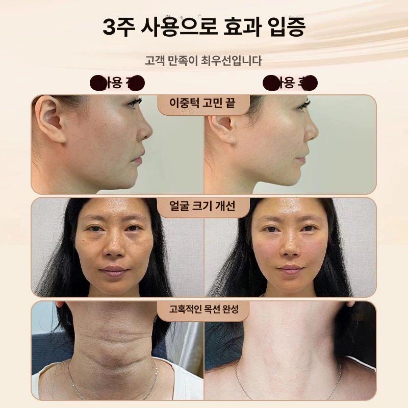 롤러 리프팅 마사지기 볼살 맛사지기 홈에스테틱 얼굴 목주름 턱라인 턱살 업그레이드 프리미엄형-충전형 요정핑크 - 상세 이미지 4