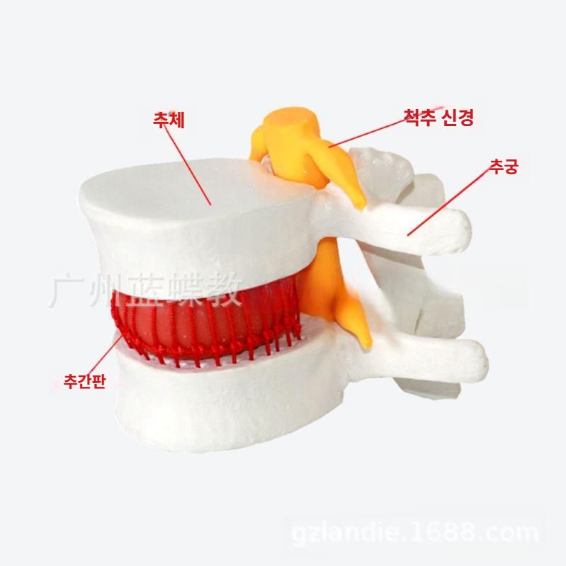 척추 모형도 디스크 요추 뼈모형 정형외과 추간판 탈출 화이트 - 상세 이미지 2