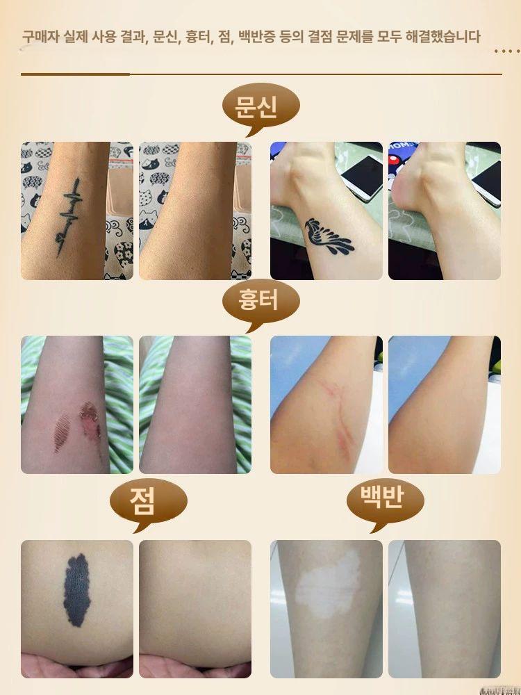 문신 가리개 커버 멍 스티커 살색 테이프 흉터 방수 스킨톤 두꺼운 5cm 폭x10개 - 상세 이미지 5