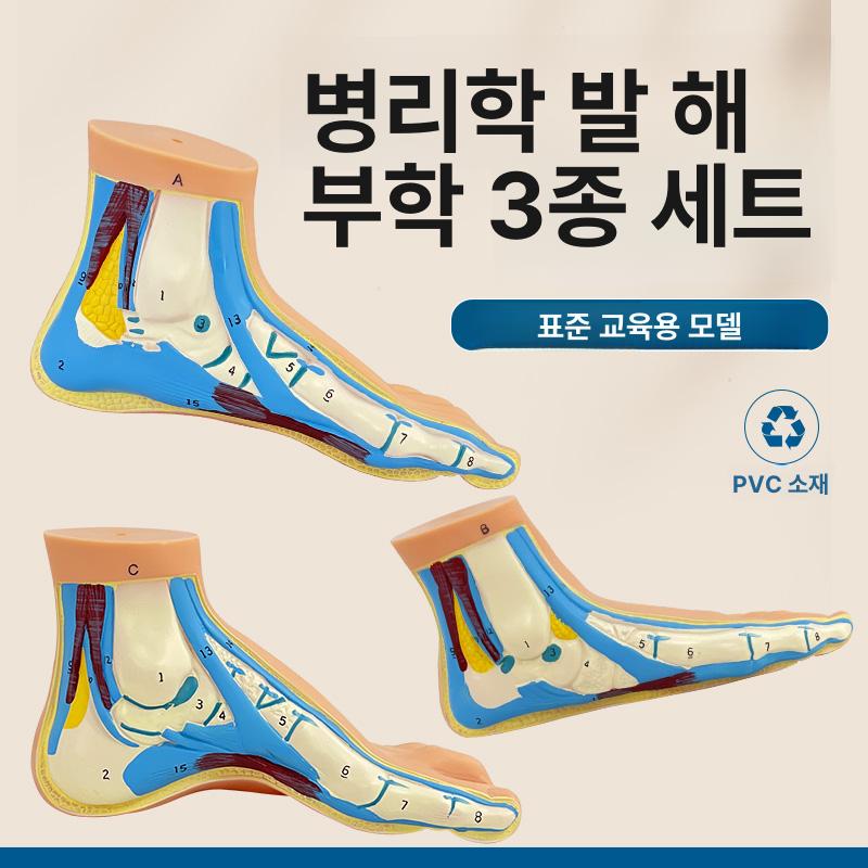 발 근육 모형 관절 해부 혈관 족저근 신경 인대 정상발 한쪽-손글씨 버전 - 상품 이미지