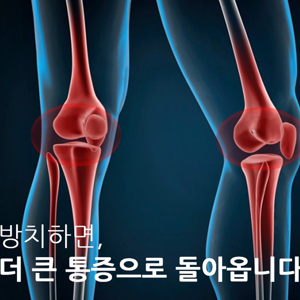 사이브 러닝 무릎보호대 슬개건 슬개골 관절 한줄 마라톤 등산 헬스 자전거 농구 보호대 이미지 6
