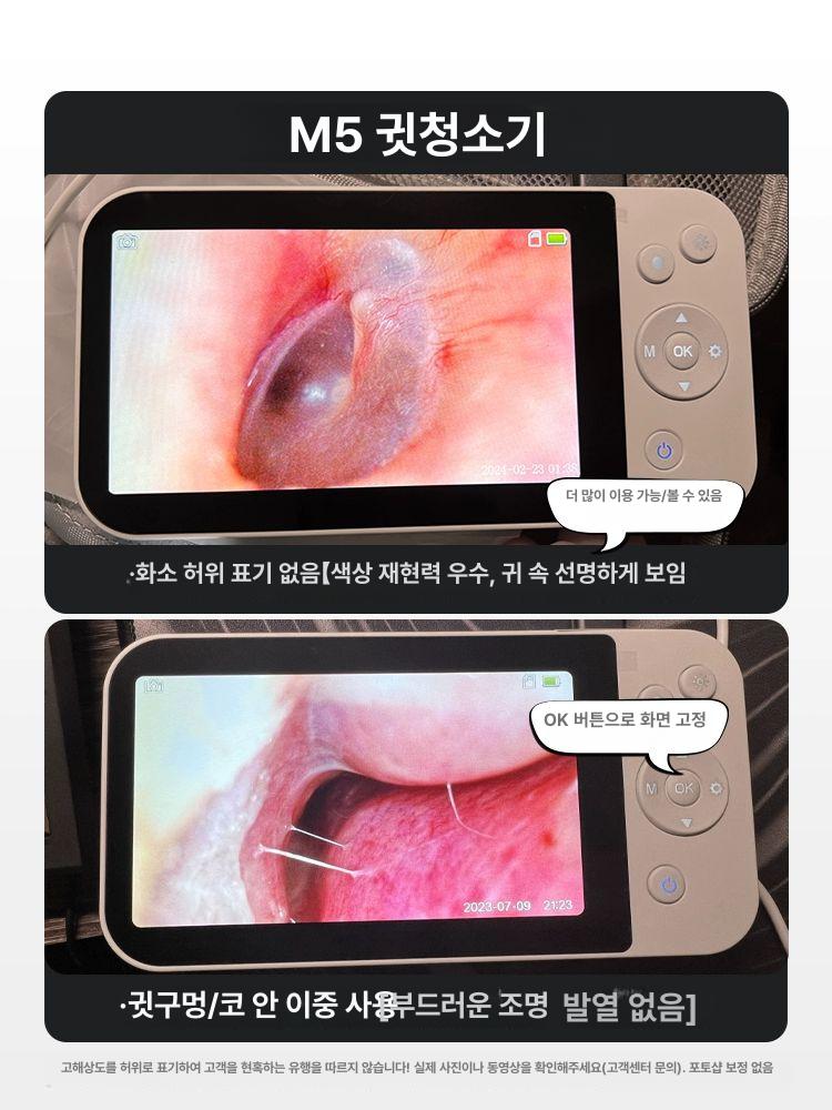 셀프 귀내시경 귀이개 귀청소 스마트폰 M5 귀지제거 세척 매장용 귀이개 세트 32G+고정밀핀셋 - 상세 이미지 2