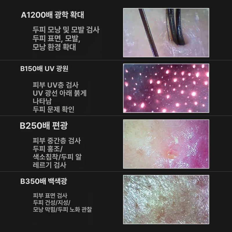 두피진단기 두피현미경 모발진단기 두피카메라 저장 모니터 분석기 스펙트럼 재고충분 확대경 듀얼 11인치 이미지 비교 - 상세 이미지 5