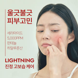 바르바라 안면 얼굴 홍조 붉은기 피부과 재생 수분 보습 판테놀 세라마이드... 솔직 후기 | 피부 타입별 분석 - 상품 이미지 2
