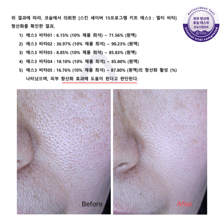 코슬 S3슈퍼리차징 앰플 나이아신아마이드 글루타치온 아데노신 항산화 광채 6ml x 5개입 - 상세 이미지 2
