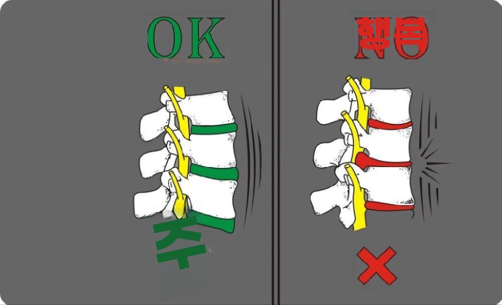 디스크 척추모형 척추 인체 허리 요추 골격 해부학 모델 - 상세 이미지 3