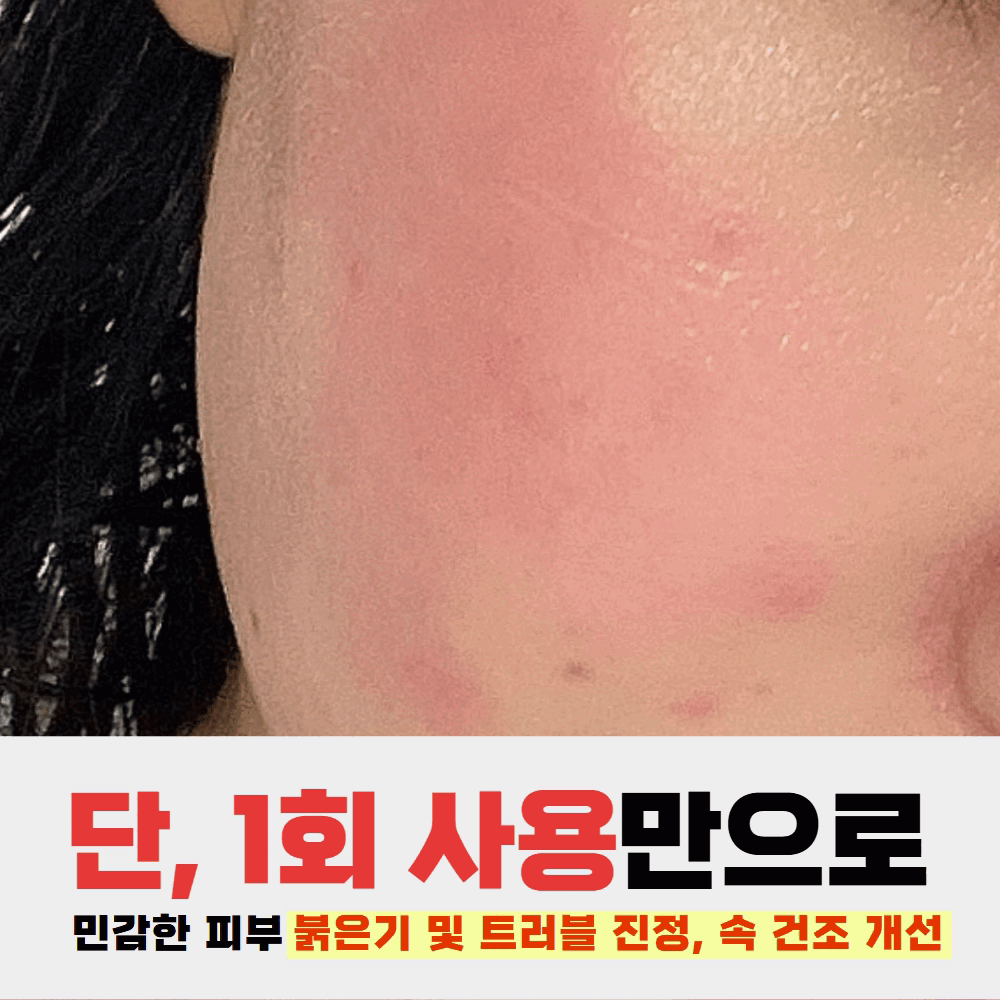 시카 레저렉션 재생크림 안면 홍조 점뺀 후 레이저 후 60ml, 1개 - 상세 이미지 3