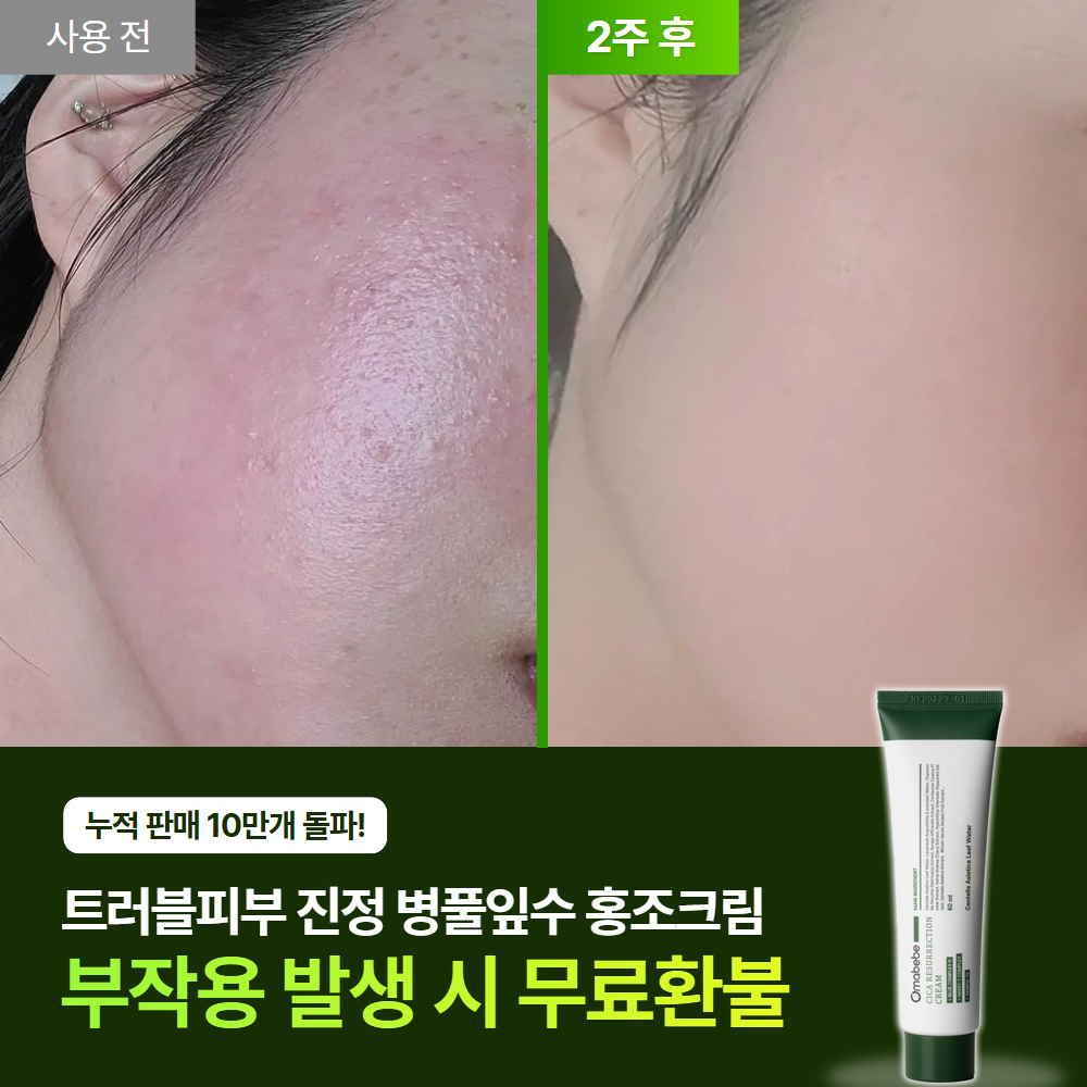 시카 레저렉션 재생크림 안면 홍조 점뺀 후 레이저 후 60ml, 1개 - 상세 이미지 2