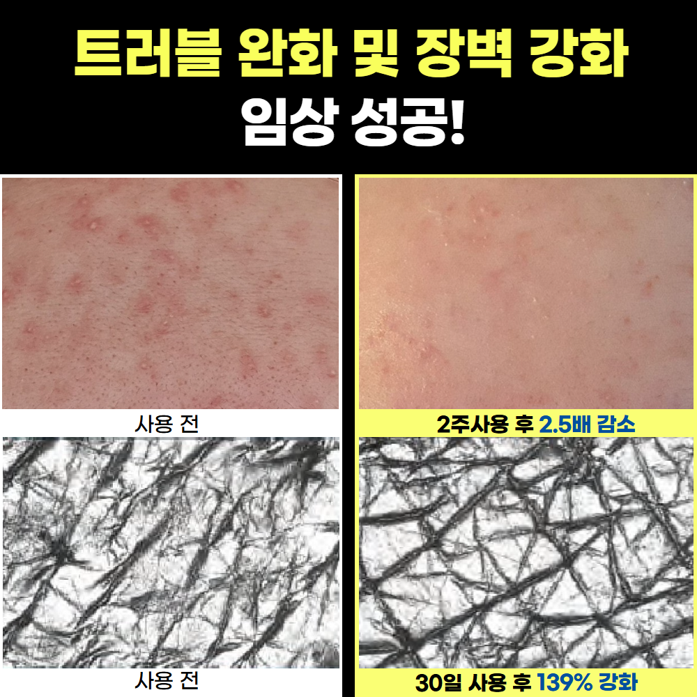 시카 레저렉션 재생크림 안면 홍조 점뺀 후 레이저 후 60ml, 1개 - 상세 이미지 4