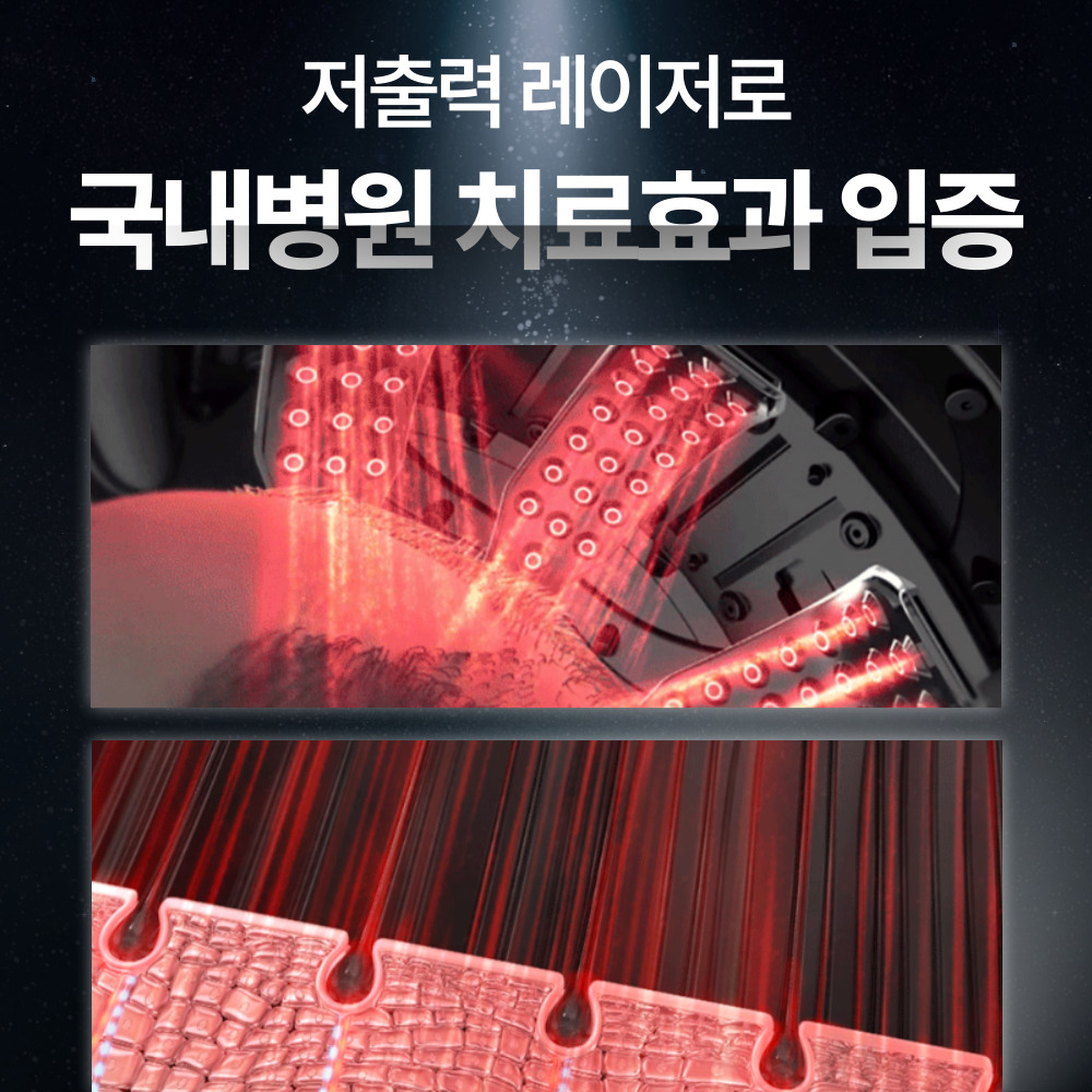 헤어빔 블랙 탈모 치료기 두피 관리기 레이저 - 상세 이미지 4
