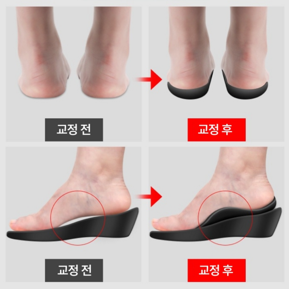 위시플러스 아치 교청 지지 깔창 (좌우2세트) - 상세 이미지 5