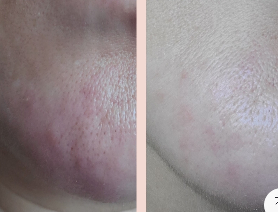 토너 미스트 광 광채 퍼스트 에센스 스프레이 쿨링 페이셜 카밍 수분 워터 보습 속건조 이미지 8