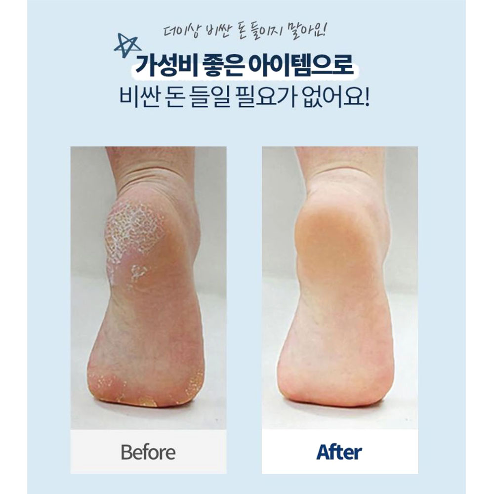 전동 굳은살 제거기 손발 뒤꿈치 발각질 위생 케어 - 상세 이미지 4