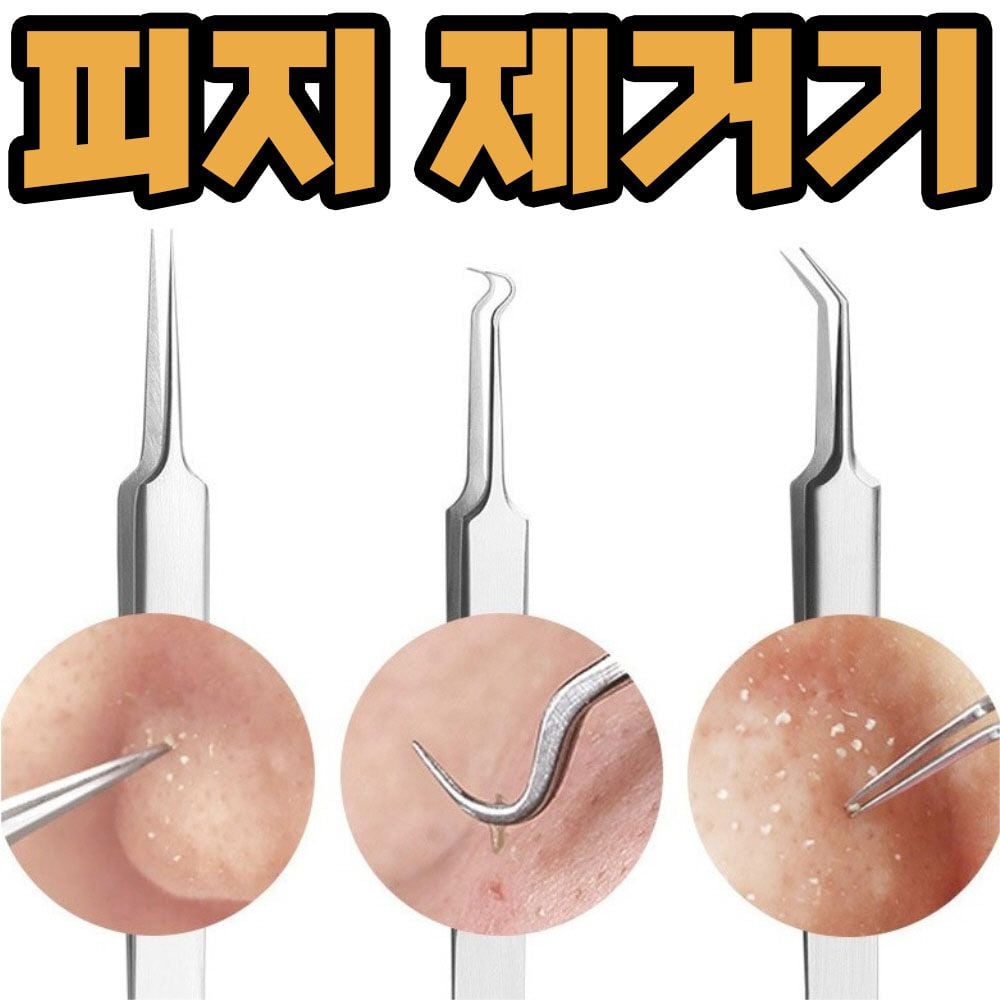 코피지 제거기 얼굴 피지 압출기 블랙헤드 뽑기 압출 L형 - 상품 이미지