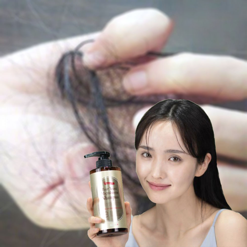 비오틴 두피 샴푸 탈모케어 맥주효모 비오틴 - 메인 이미지