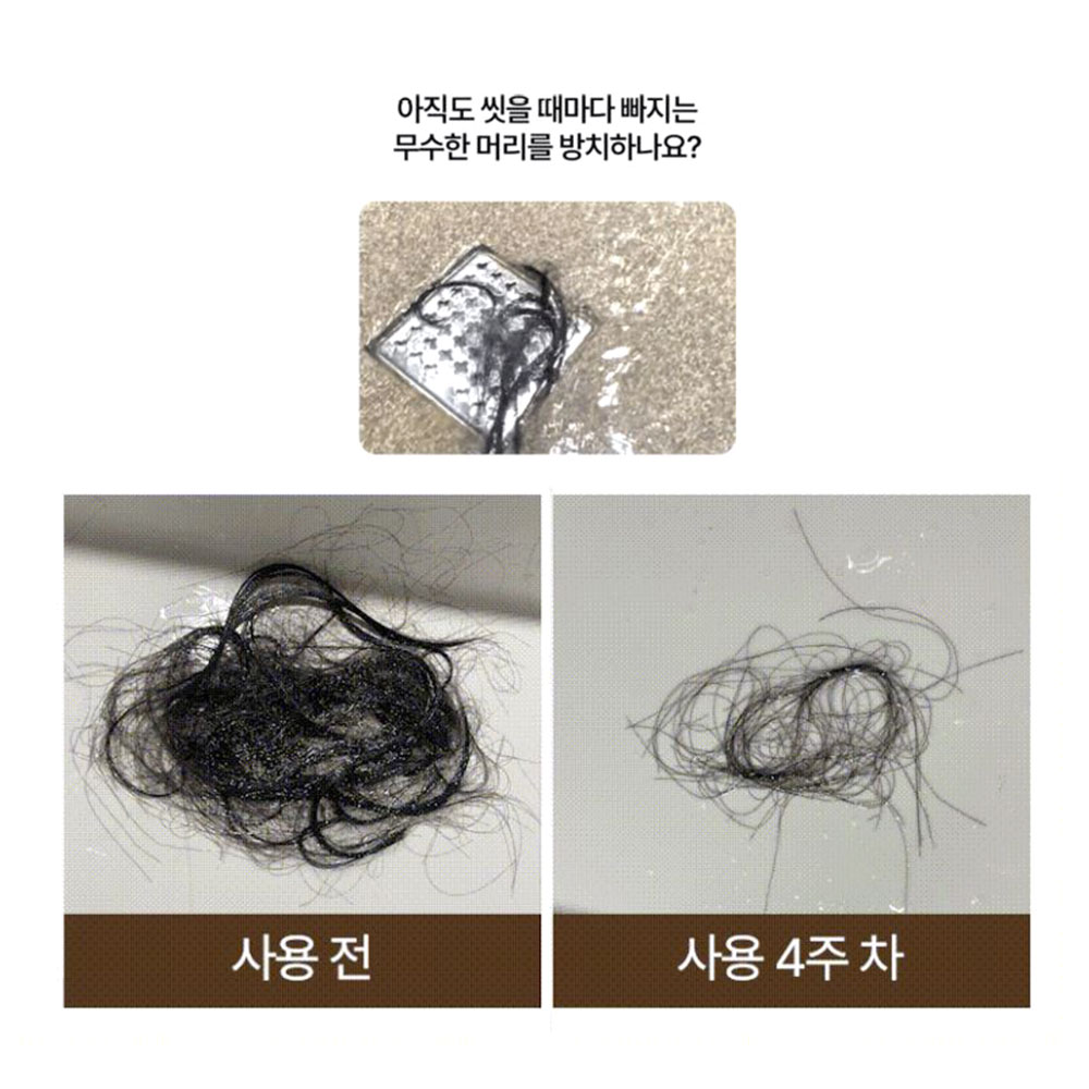 비오틴 두피 샴푸 탈모케어 맥주효모 비오틴 - 상세 이미지 3