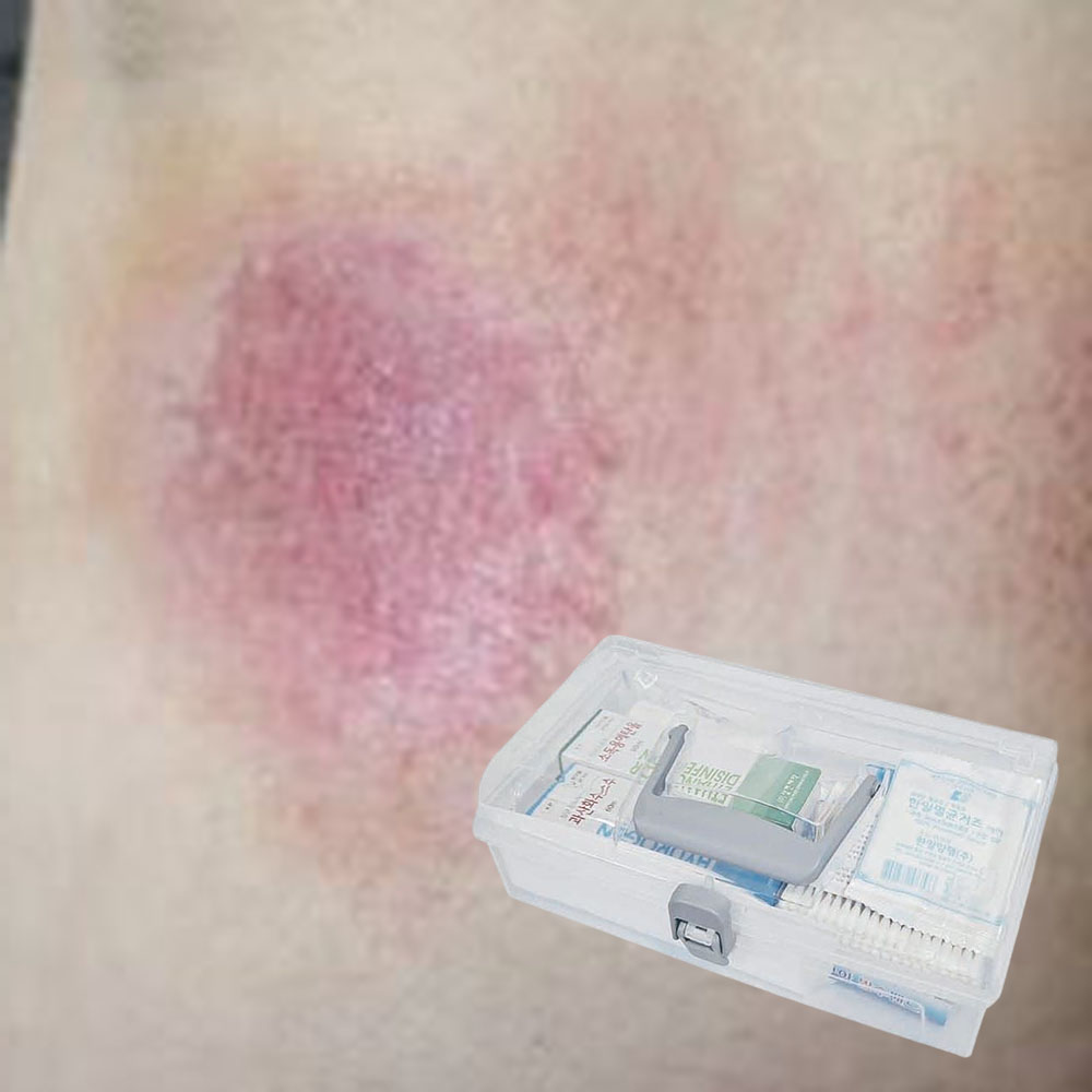 가정용 응급 구급함 긴급 가족 상처 치료 휴대용 상비약 - 상품 이미지