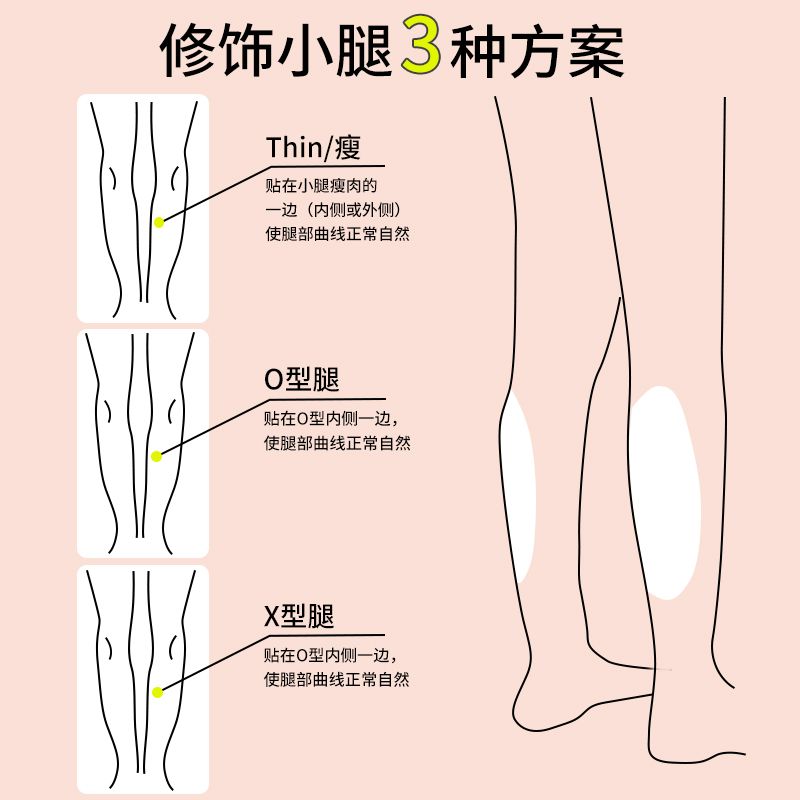 O자 일자다리 실리콘 다리 패드 스티커 싱글 보정 종아 - 상세 이미지 4