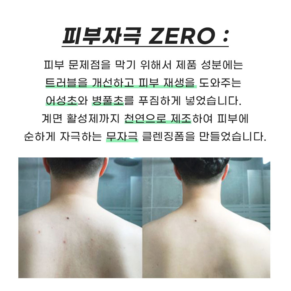 여드름 모낭염 비누 2개입 코코넛 얼굴 세안용 - 상세 이미지 4