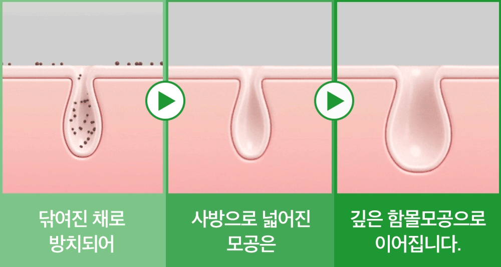 sungboon editor green tomato chemical exfoliant