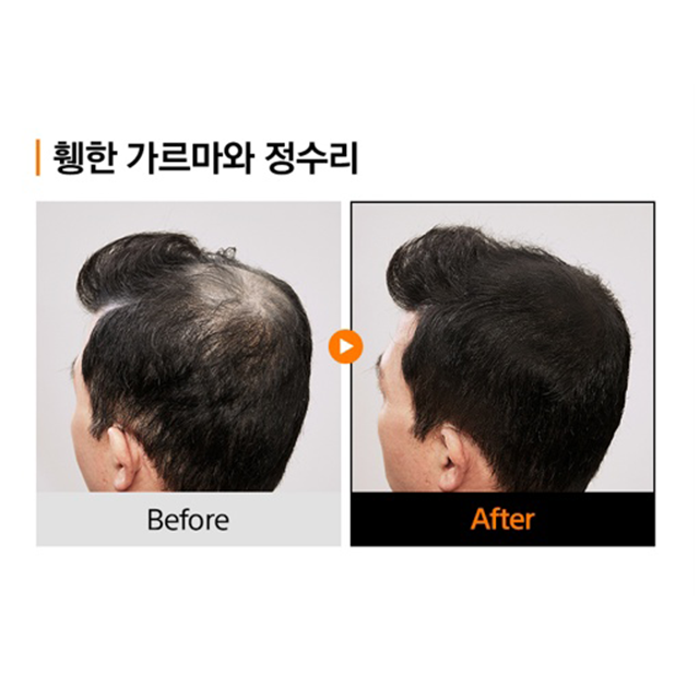 누아레모 두피타투브러쉬 정수리커버 20ml, 1개 이미지 3