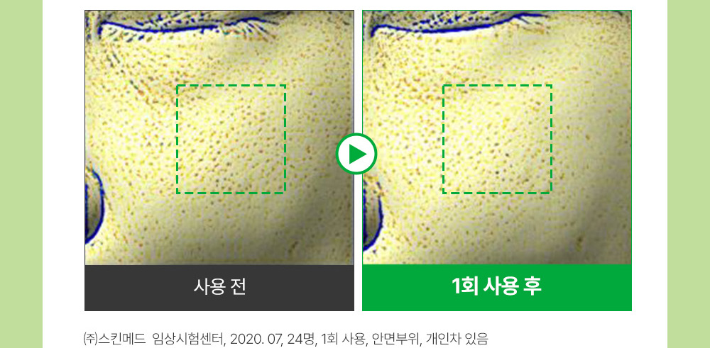sungboon editor green tomato concentrated ampoule