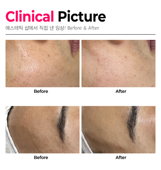 더라포 R앰플 50ml 주름 재생 안티에이징 - 상세 이미지 3