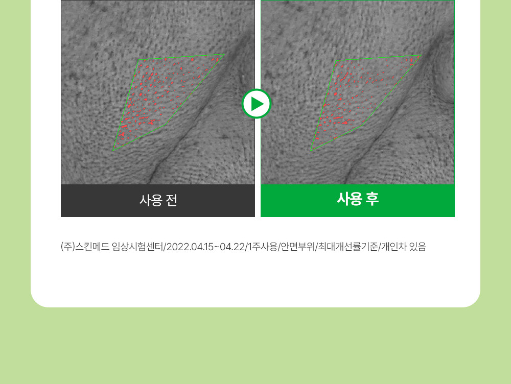 sungboon editor green tomato concentrated ampoule