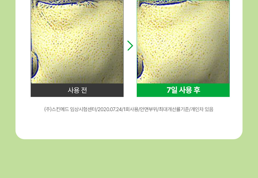 sungboon editor green tomato concentrated ampoule