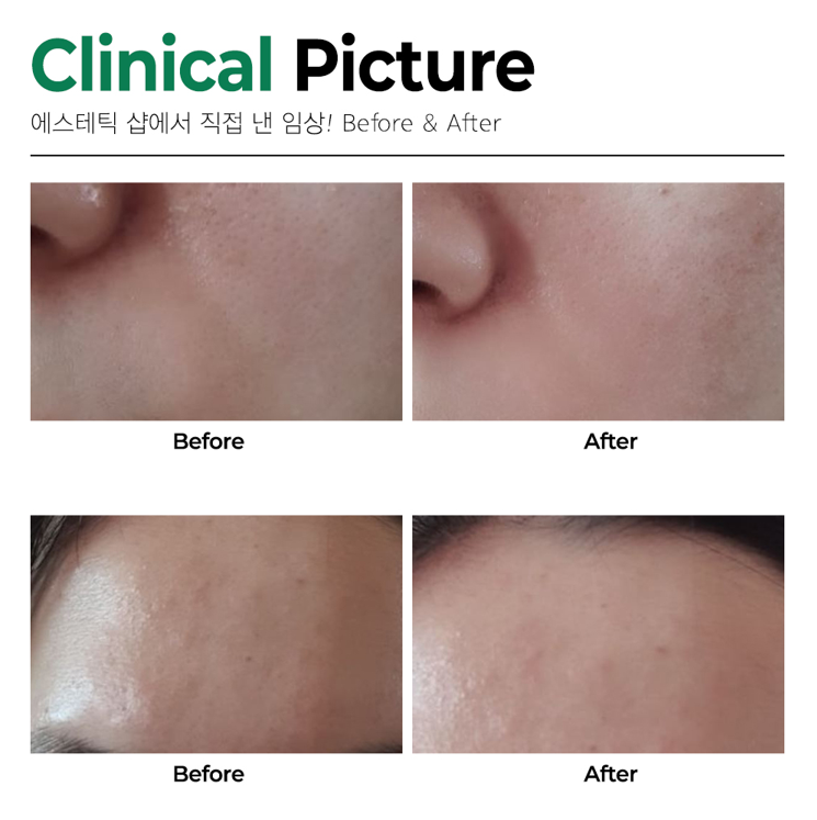 더라포 S앰플 50ml 진정 - 상세 이미지 5
