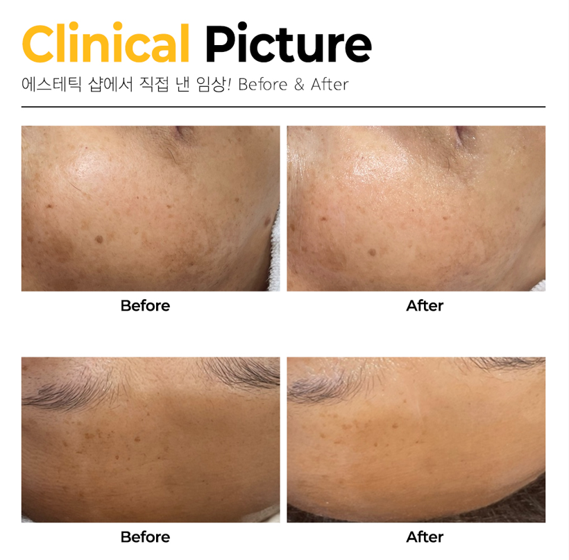 더라포 W앰플 미백 생기 톤업 50ml - 상세 이미지 3