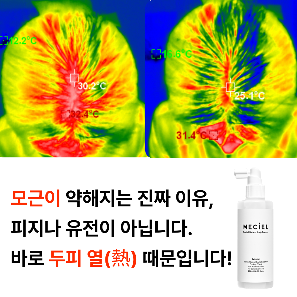 메시엘 두피토닉 에센스 헤어 영양제 맥주효모 세럼 쿨링 약산성 진정 비듬 무향, 200ml, 4개 - 상세 이미지 2
