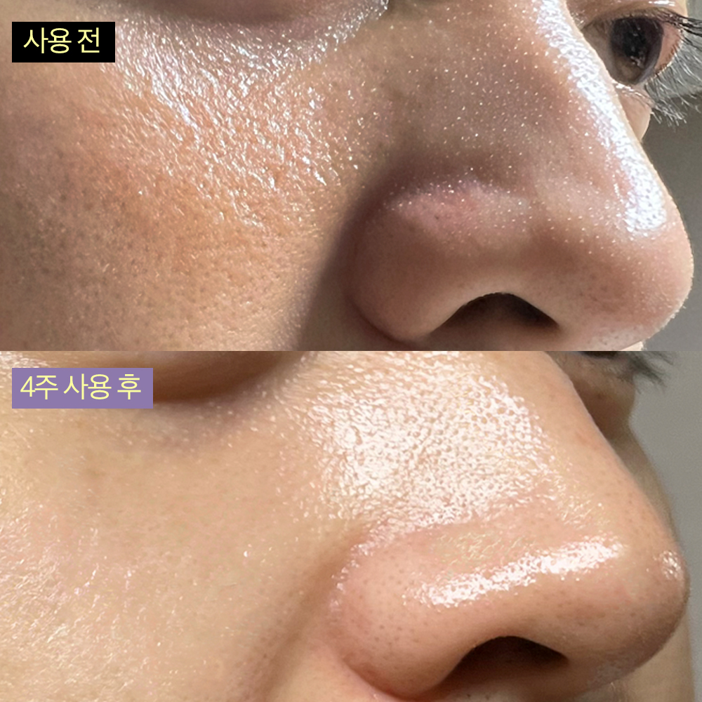 [약국입점] 슬리슬리 PDRN 피디알엔 바쿠치올 히알루론산 모공 쫀쫀 세럼 30ml, 1개 - 상세 이미지 2