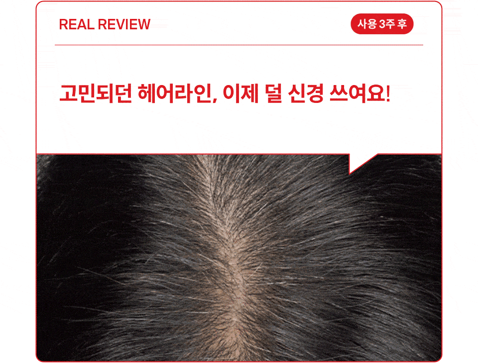 DR.FORHAIR Folligen Thickening Scalp Serum - details 5