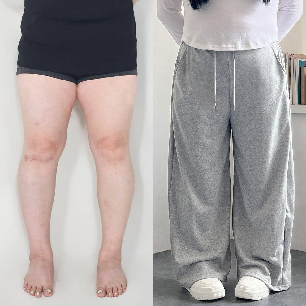 1+1 핀턱바지 키작녀 와이드팬츠 - 상품 이미지