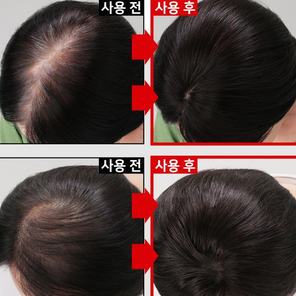 감쪽이 인모 100 가발 3초 똑딱이 초경량 빈모 여성 정수리 볼륨가발 - 상세 이미지 4
