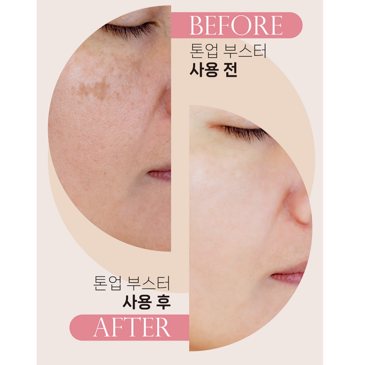 저자극 바디 미백 크림 피부 진정 바디 톤업 크림 스프레이 - 상세 이미지 3
