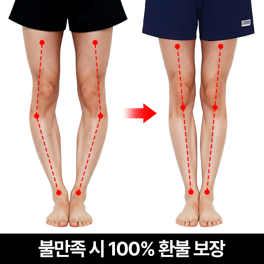 호미홈 오팔인솔 오다리 팔자걸음 O다리 교정 깔창 팔자 걸음걸이 내반슬교정용품