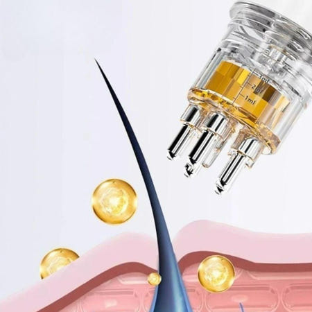 탈모영양제도포기 헤어 토닉 도포기 로게인폼 미녹시딜 두피 마이녹실