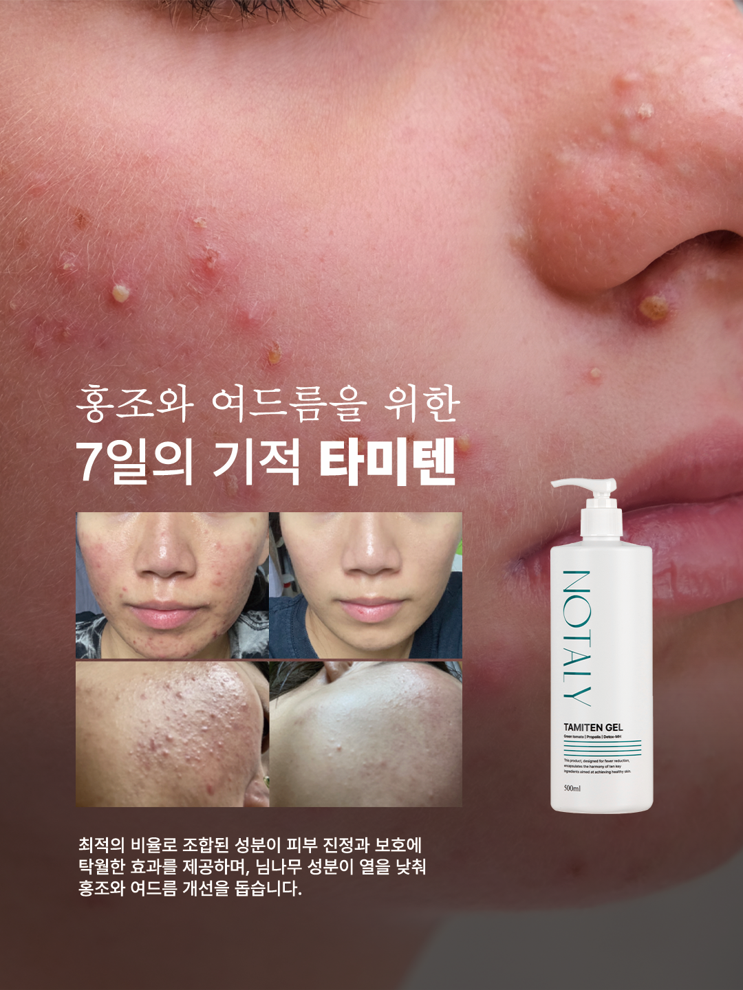 노탈리 타미텐 토너 500ml 진정 수분 토너 - 상세 이미지 4