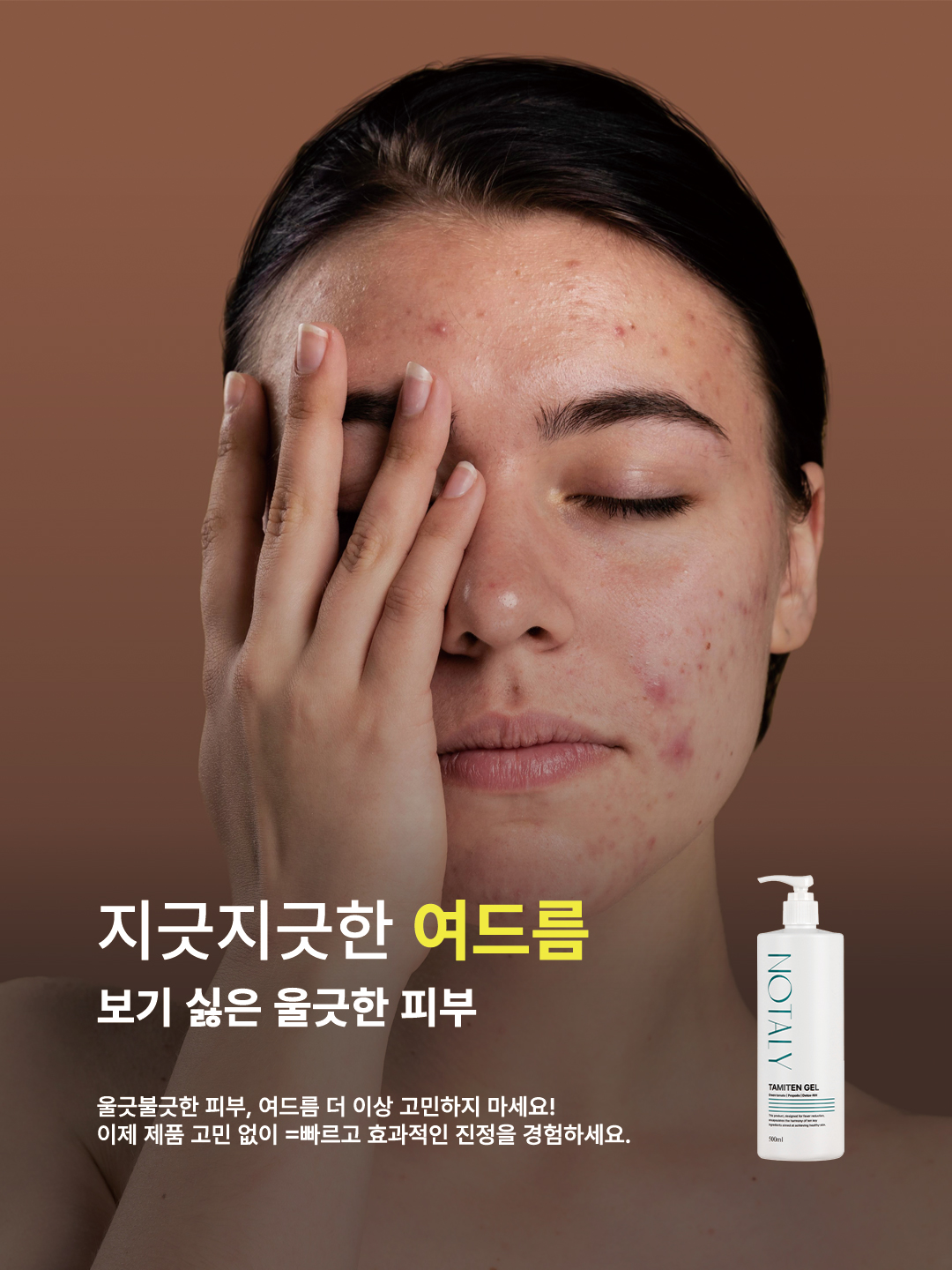 노탈리 타미텐 토너 500ml 진정 수분 토너 - 상세 이미지 5