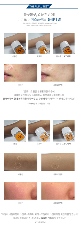 더라포 아이스 플랜트 블래더 겔 150ml - 상세 이미지 4