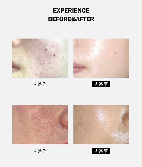 더라포 피일러 크림 50ml 수분물광 피부강화 - 상세 이미지 5
