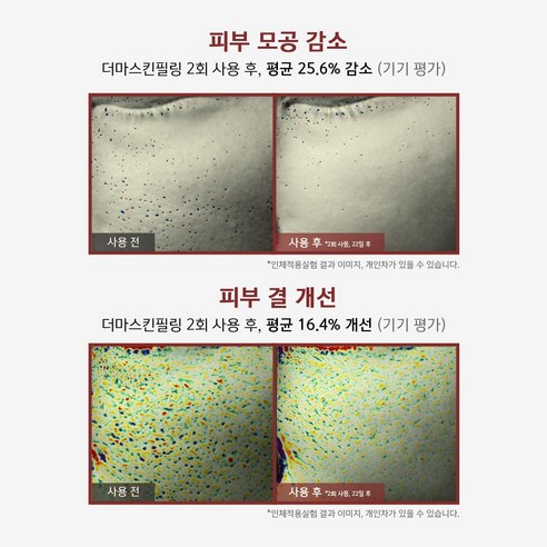 비큐셀 새살필 해초필링 약초필링 스피큘 피부박피 - 상세 이미지 3