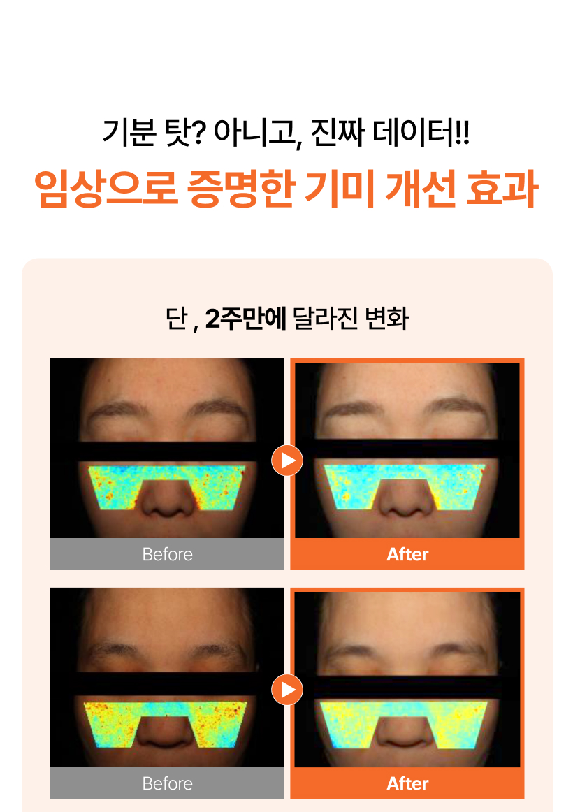 MQNY Dark Spot Zero Whitening Cream - description 4